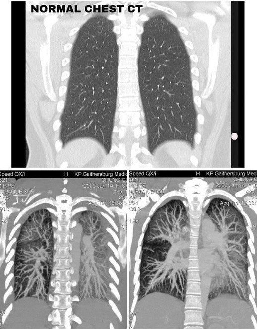Thuốc lá điện tử: Mối nguy hại mới đối với sức khỏe thanh thiếu niên Thuốc lá điện tử: Mối nguy hại mới đối với sức khỏe thanh thiếu niên