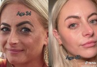 Scotland: Bí quyết có làn da căng bóng khỏe đẹp của người phụ nữ 40 tuổi