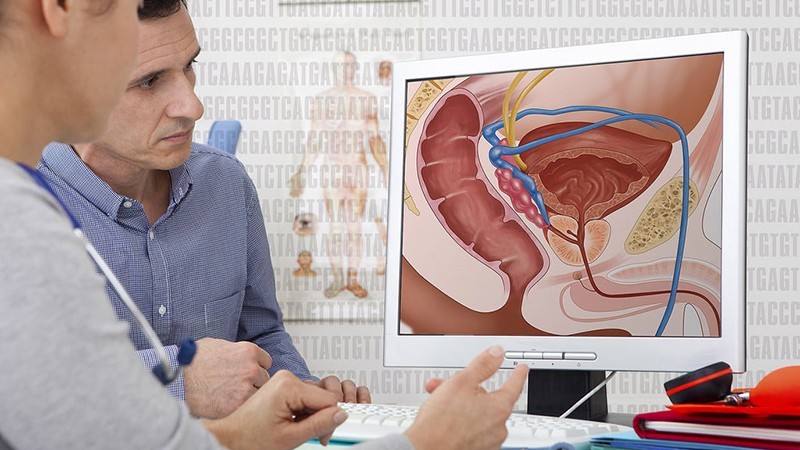 Đã tìm ra phương pháp mới điều trị ung thư tuyến tiền liệt