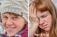 Thiếu ngủ hay ngủ quá nhiều đều có hại