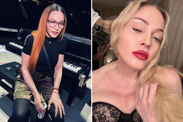 Madonna nhiễm khuẩn nặng, cần nghỉ dưỡng dài ngày, không thể lưa diễn vòng quanh thế giới Madonna nhiễm khuẩn nặng, cần nghỉ dưỡng dài ngày, không thể lưa diễn vòng quanh thế giới