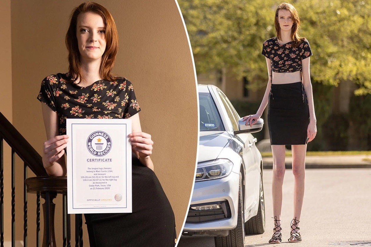 Cô gái có đôi chân dài nhất thế giới tâm sự về những trở ngại trong cuộc sống Cô gái có đôi chân dài nhất thế giới tâm sự về những trở ngại trong cuộc sống