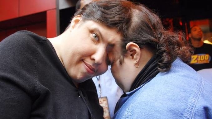 Cặp song sinh dính liền sống lâu nhất thế giới qua đời