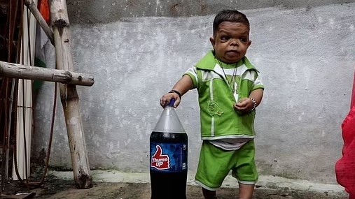 Mắc bệnh thiếu hụt tăng trưởng, anh thanh niên Ấn Độ 25 tuổi chỉ cao 61cm