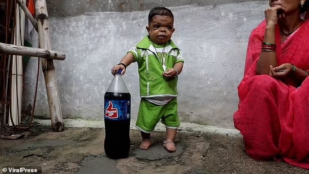 Mắc bệnh thiếu hụt tăng trưởng, anh thanh niên 25 tuổi chỉ cao 61cm