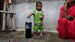 Mắc bệnh thiếu hụt tăng trưởng, anh thanh niên Ấn Độ 25 tuổi chỉ cao 61cm