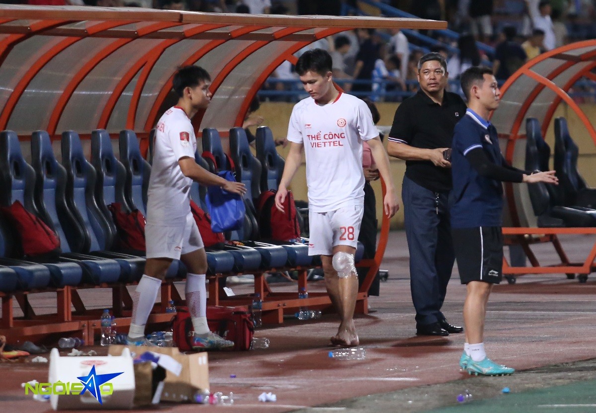 Hoàng Đức phải rời sân ở phút 68 trận đấu giữa CAHN và Thể Công Viettel ở vòng 21 V-League tối 26/5. Tiền vệ người Hải Dương được nhắc tới rất nhiều trong những ngày qua khi truyền thông liên tục đưa tin anh chuẩn bị ra nước ngoài thi đấu.