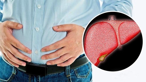 3 triệu chứng cảnh báo gan nhiễm mỡ ở phụ nữ