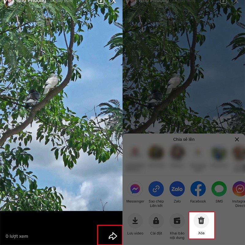 Xóa story trên TikTok chỉ với vài thao tác đơn giản Xóa story trên TikTok chỉ với vài thao tác đơn giản
