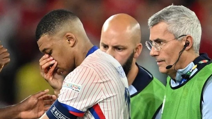 Kylian Mbappe sẽ phải đeo mặt nạ nếu thi đấu EURO 2024?