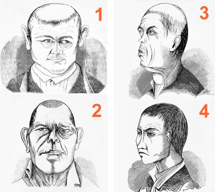 Bác sĩ Cesare Lombroso mô tả chi tiết đặc điểm khuôn mặt liên quan đến các nhóm tội phạm khác nhau bao gồm hiếp dâm, cướp, trộm và ám sát (theo thứ tự 1-4). (Nguồn: Science History) Bác sĩ Cesare Lombroso mô tả chi tiết đặc điểm khuôn mặt liên quan đến các nhóm tội phạm khác nhau bao gồm hiếp dâm, cướp, trộm và ám sát (theo thứ tự 1-4). (Nguồn: Science History)