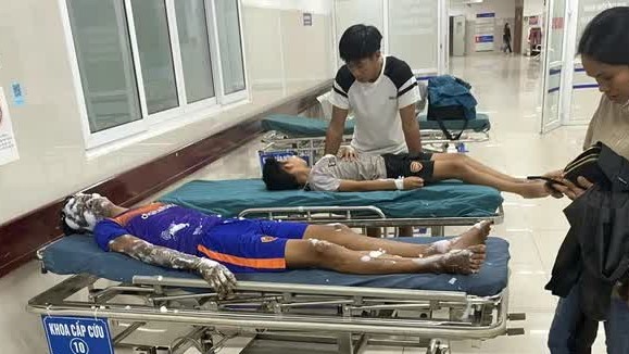 Tự chế pháo nổ, bốn học sinh ở Quảng Bình nhập viện cấp cứu