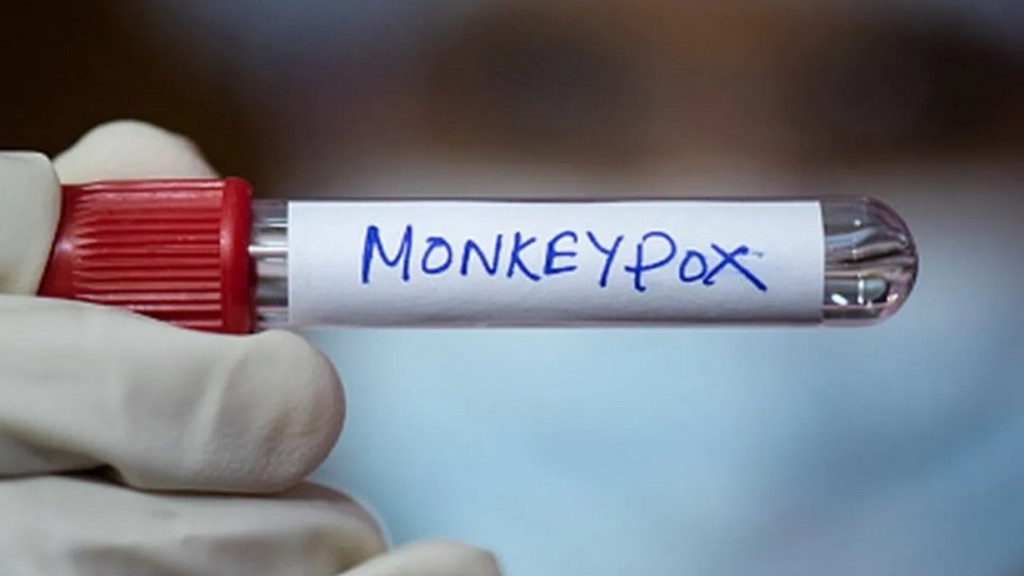 WHO cảnh báo sự bùng phát bệnh đậu mùa khỉ ở châu Phi với hơn 14.700 ca mắc