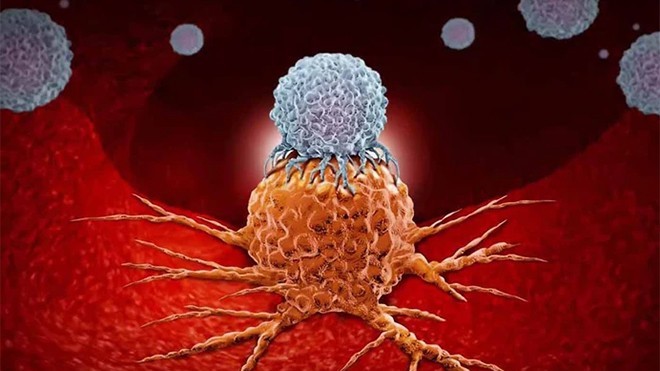 Australia tìm ra phương pháp điều trị mới cho bệnh nhân mắc bệnh xơ tủy