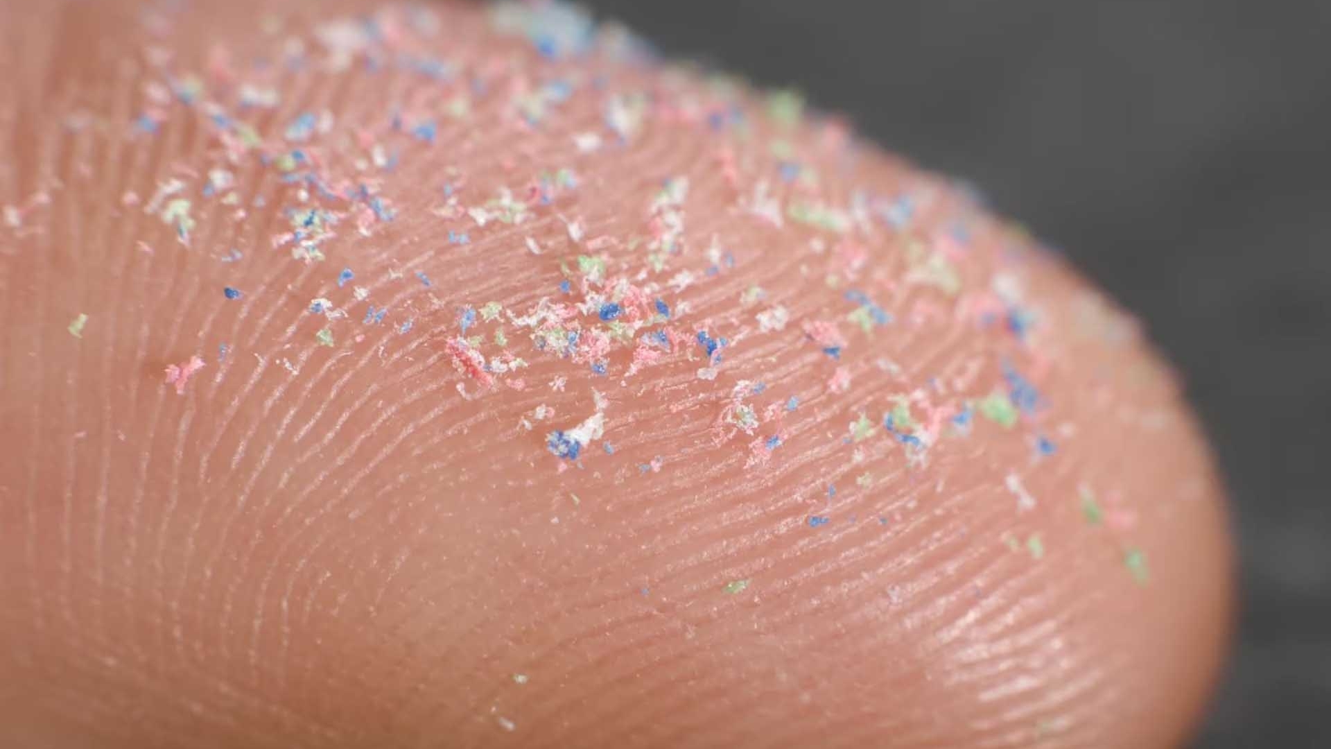 Phát hiện mới về vi nhựa trong não người