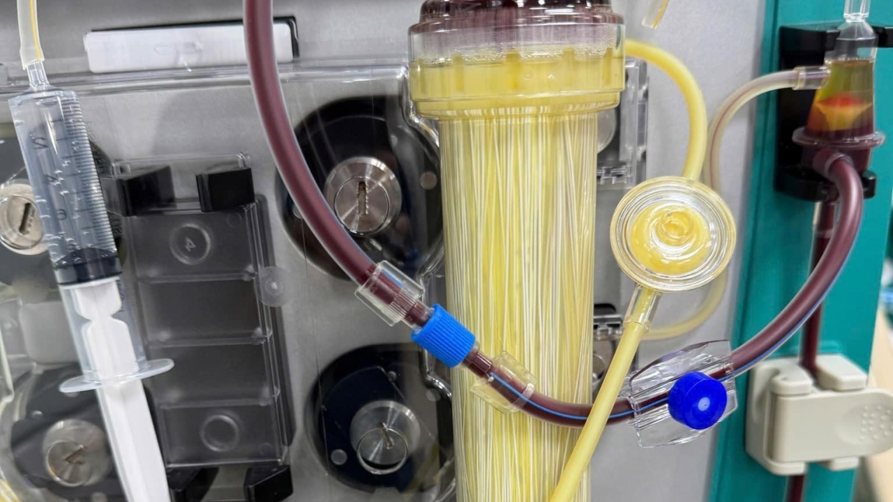 Chuyên gia y tế nói gì về chuyện 'lọc máu ngừa đột quỵ'?