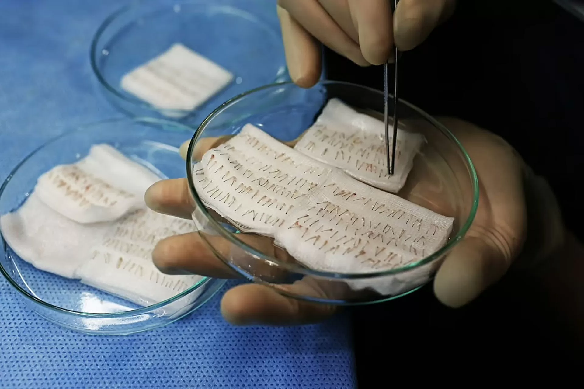 ‘Thủ phủ cấy tóc’ thế giới