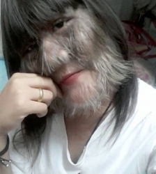 Câu chuyện truyền cảm hứng về lối sống tốt đẹp của cô gái mắc 