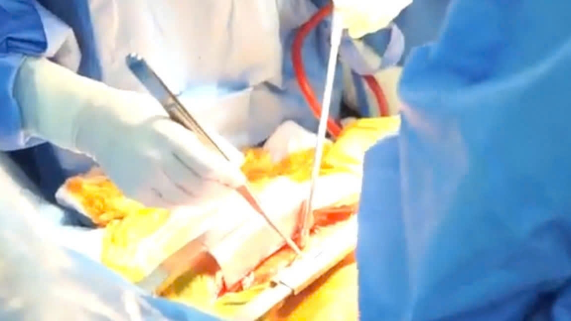 Sự sống hồi sinh nhờ ghép tạng- Điều kỳ diệu tiếp tục xuất hiện