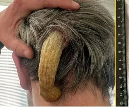 sừng mọc trên đầu