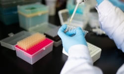 Dịch Covid-19 quay trở lại mạnh mẽ, Bộ Y tế khuyến cáo những nhóm người sau cần điều trị tại bệnh viện