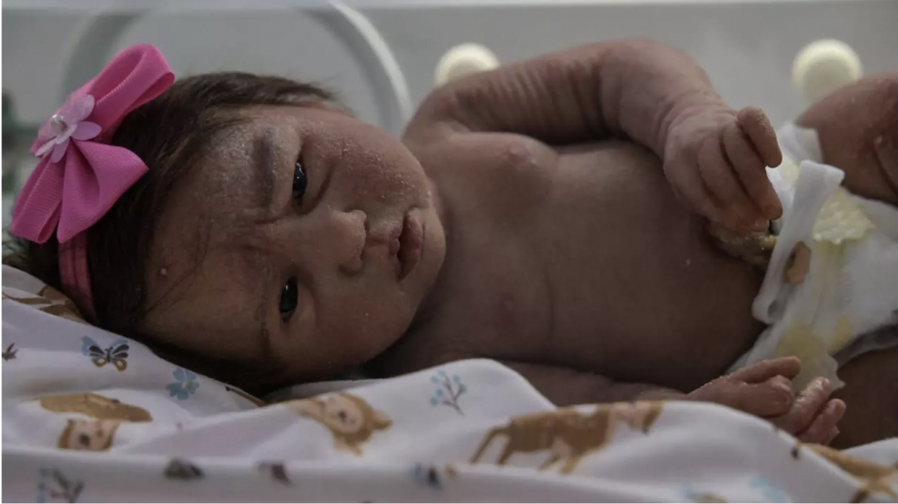 Brazil tranh cãi gay gắt vì búp bê giống người thật