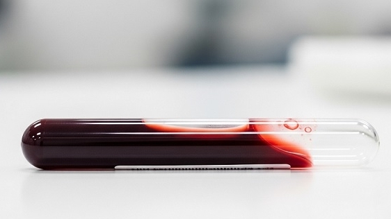 Người phụ nữ duy nhất trên thế giới mang nhóm máu mới