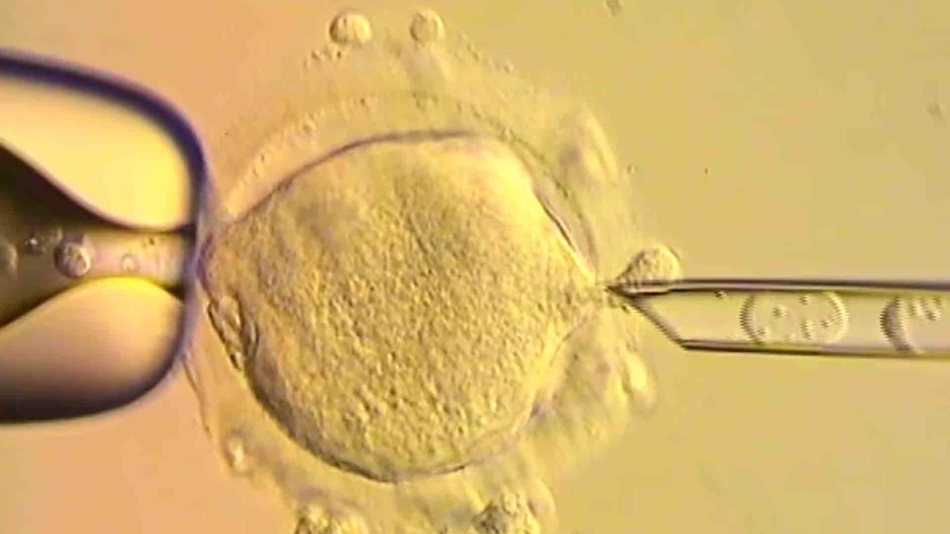 Anh thử nghiệm thành công phương pháp IVF ngăn bệnh di truyền ty thể