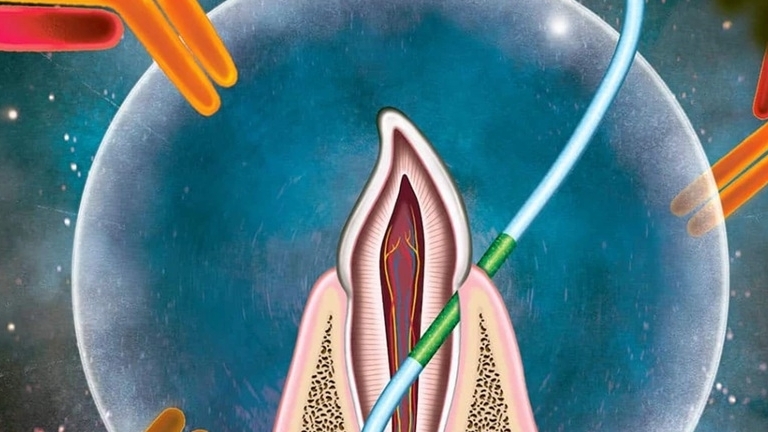 Một loại vaccine mới không cần kim tiêm, có tác dụng như chỉ nha khoa, cần nghiên cứu thêm