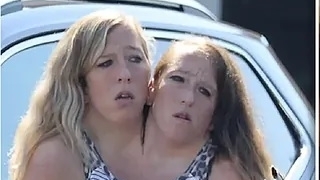 Cặp song sinh dính liền nổi tiếng gây tò mò sau loạt ảnh mới