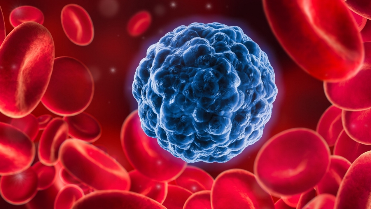 Phát hiện cơ chế mới khiến ung thư di căn