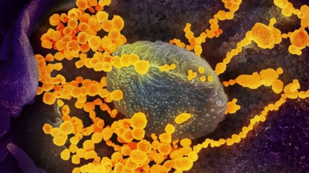 Phát hiện bất ngờ về loại thuốc có thể 'thách thức' các biến thể của Covid-19