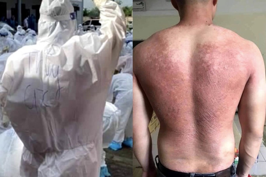 Những khoảnh khắc chạm đến trái tim tại tâm dịch Covid-19 ở Bắc Giang