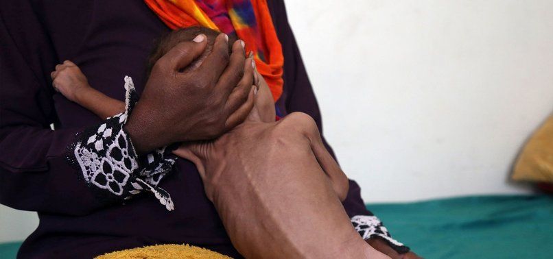 UNICEF: Hơn 30% trẻ em thế giới có vấn đề về dinh dưỡng unicef hon 30 tre em the gioi co van de ve dinh duong