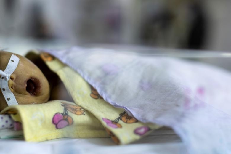 Hình ảnh bên trong bệnh viện nhi ở Kabul khi hệ thống y tế của Afghanistan rơi vào khủng hoảng