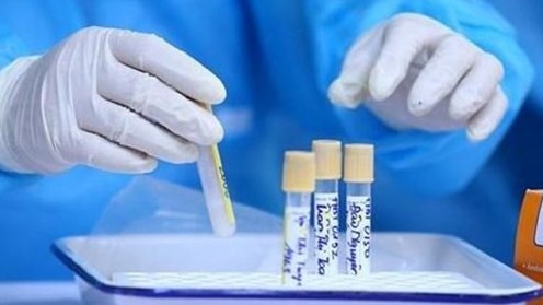 Covid-19: Hải Dương phát hiện chùm ca bệnh chưa rõ nguồn lây, TP. Lai Châu tạm dừng một số hoạt động không thiết yếu