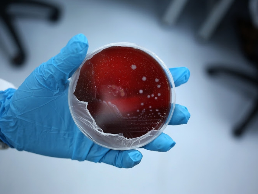 ​Nam Phi cảnh báo nguy cơ bùng phát nhiễm khuẩn Listeria