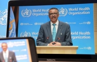 moi uae phat trien cong nghe laser phat hien sars cov 2 trong vai giay