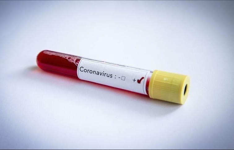 Dịch Covid-19: Virus 'đụng' trúng Ngoại trưởng Bolivia, cảnh báo kịch bản xấu nhất ở Anh, Campuchia thêm 9 ca bệnh