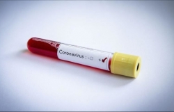 Dịch Covid-19: Virus 'đụng' trúng Ngoại trưởng Bolivia, cảnh báo kịch bản xấu nhất ở Anh, Campuchia thêm 9 ca bệnh