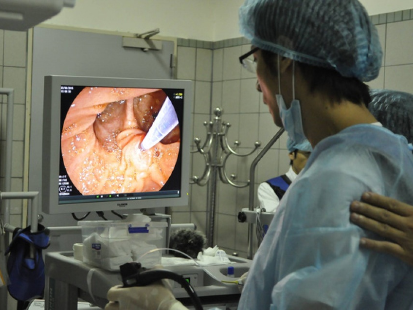 Cách nào phát hiện sớm ung thư đường tiêu hóa?