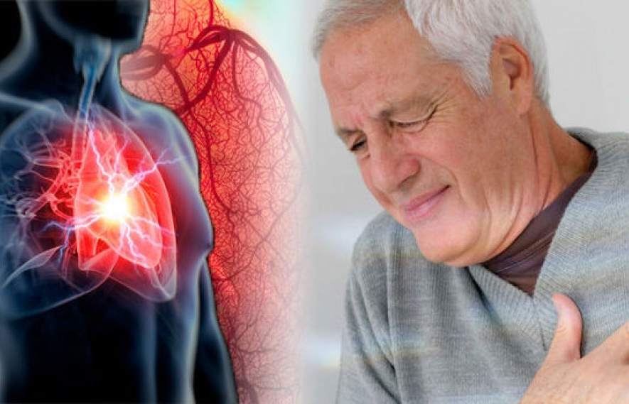 48% số người Mỹ trưởng thành mắc các bệnh lý về tim mạch