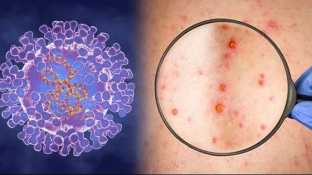 Sinh tồn trong ‘Kỷ đại dịch’