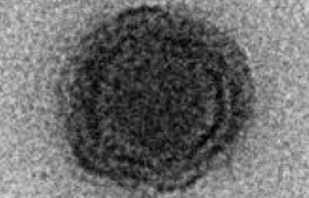 Brazil: Phát hiện virus lạ với 90% gien chưa từng được biết tới