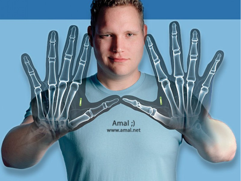 Thiết bị cấy ghép sinh học dưới da