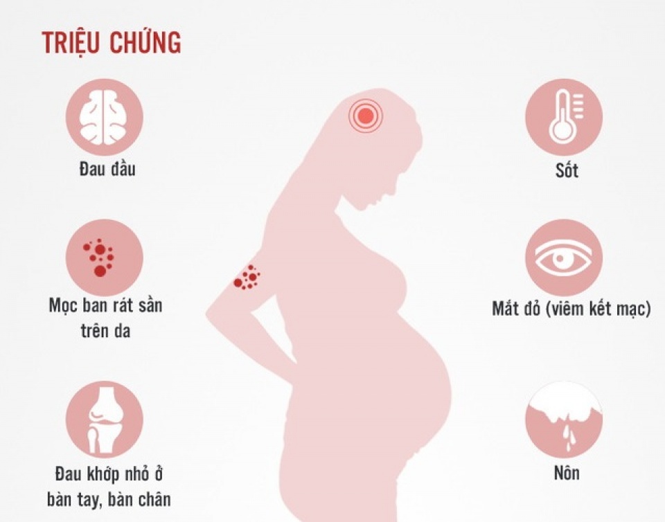 Infographics: Toàn cảnh về khả năng virus Zika "tấn công" thai phụ