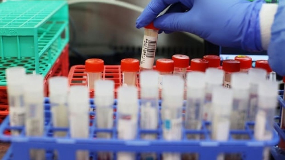 Biến thể cũ vẫn đang 'hoành hành', Anh lại có thêm biến thể SARS-CoV-2 mới đáng sợ hơn