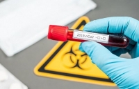 nhung thong diep trai tim cua nguoi viet tai czech