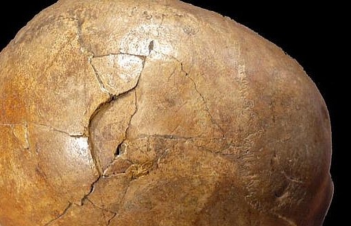 Giải mã bí ẩn vụ án mạng thời kỳ đồ đá