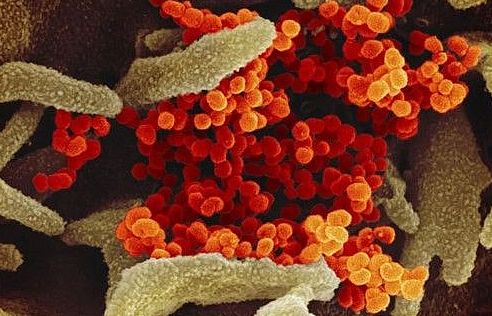 Cập nhật 19h ngày 1/5: Nhật Bản, Ấn Độ thử nghiệm thuốc chống Covid-19, Belarus số ca mắc nhiều thứ 2 ở Trung - Đông Âu, Lào nới lỏng hạn chế